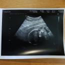 59 Bump Face 25 May 2018