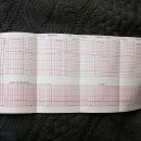 50 Baby Heartbeat 21 May 2018