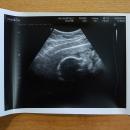 58 Bump Profile 25 May 2018